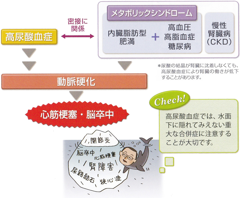 「尿酸値が高い」方必見！尿酸値が高いとなぜいけないの？「尿酸」と「高尿酸血症」 医療法人神楽岡泌尿器科