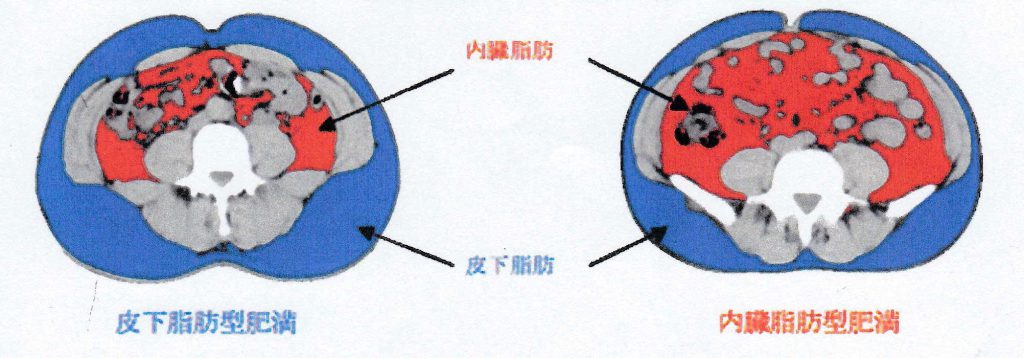 metabolic_2