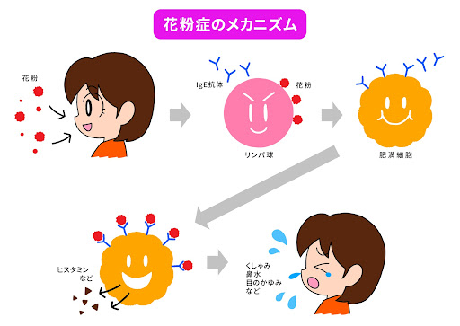 花粉症のメカニズム