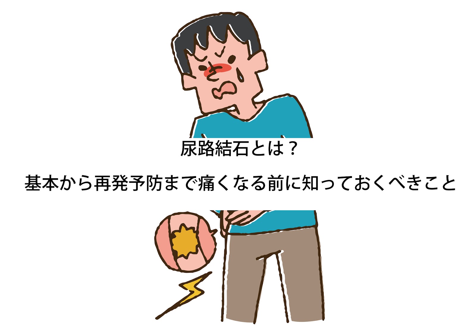 尿路結石｜泌尿器科｜診療科・部門｜【公式】医療法人社団友志会