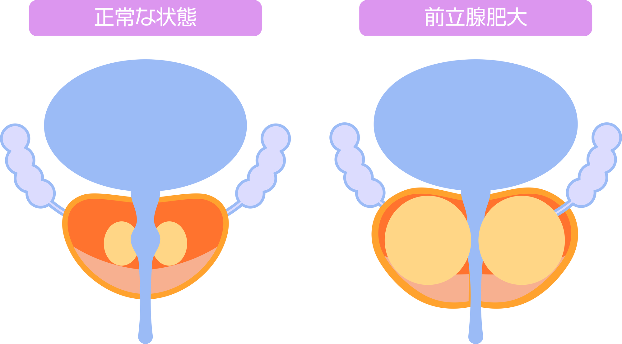 「年々おしっこの切れが悪くなってきた」理由・改善方法を泌尿器科が解説 - 医療法人神楽岡泌尿器科 | 北海道旭川市