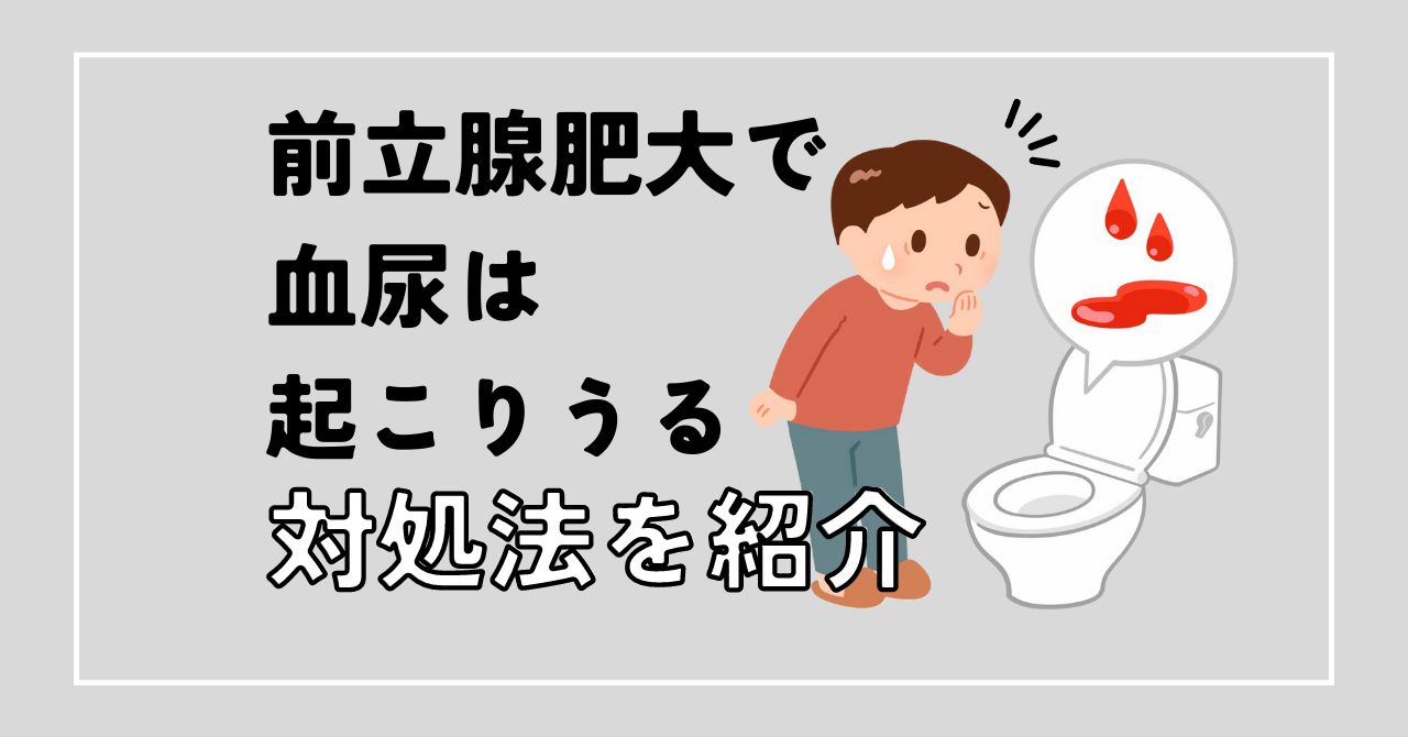 前立腺肥大で血尿は起こりうる！泌尿器科が対処法を紹介