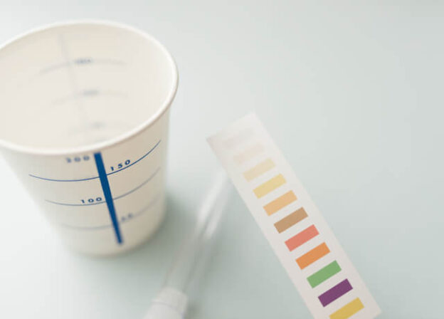 止まらない血尿は要注意！考えられる原因と受診の目安を医師が解説