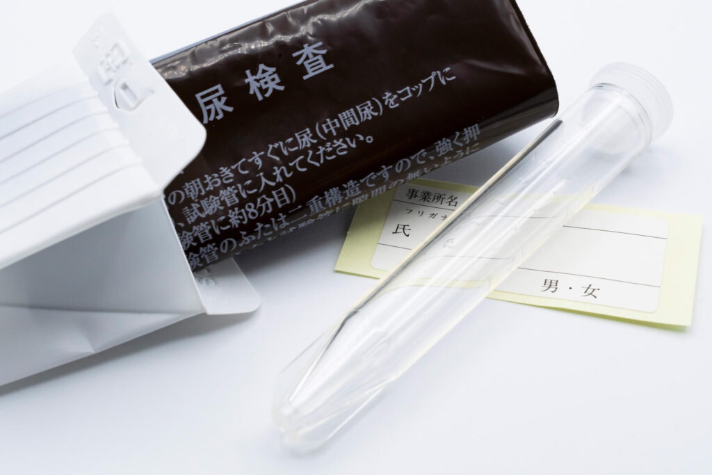 正しく採尿できなかった時の具体的な対処法