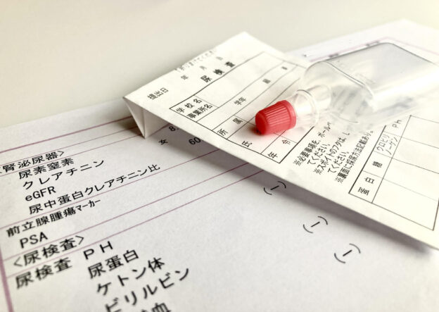 学校の尿検査で「起立性蛋白尿」の疑い？子どもの尿蛋白の原因